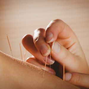 SS-Acupuncture-Heal-Your-Body-with-Ancient-Chinese-Therapy-scaled